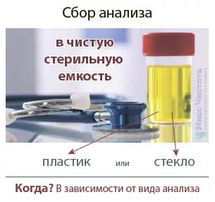 Скільки та як зберігати сечу для аналізу до здачі в лабораторію